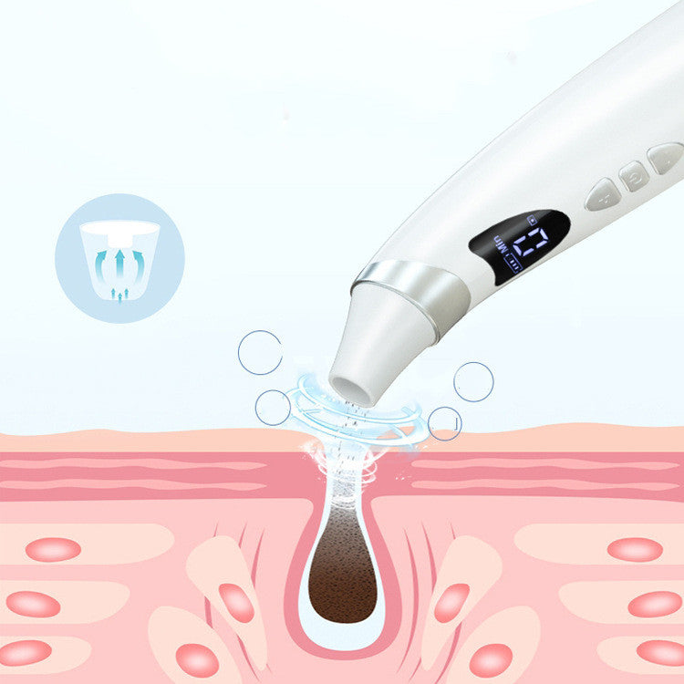 Electric Visual Blackhead Suction Device